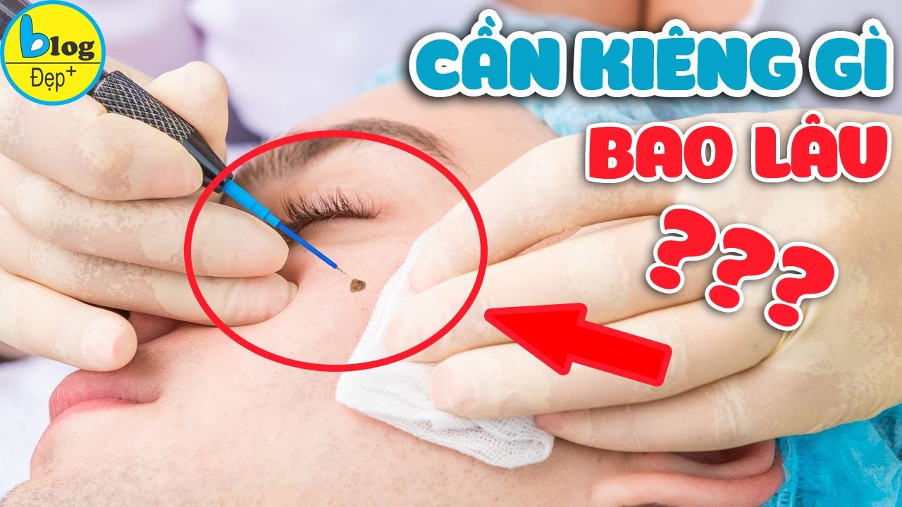 Chăm sóc sau tẩy nốt ruồi