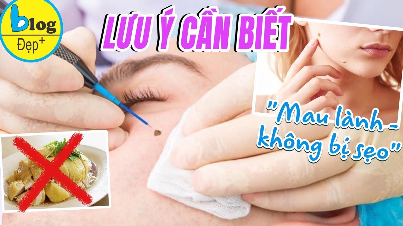 Những điều nên tránh sau tẩy nốt ruồi