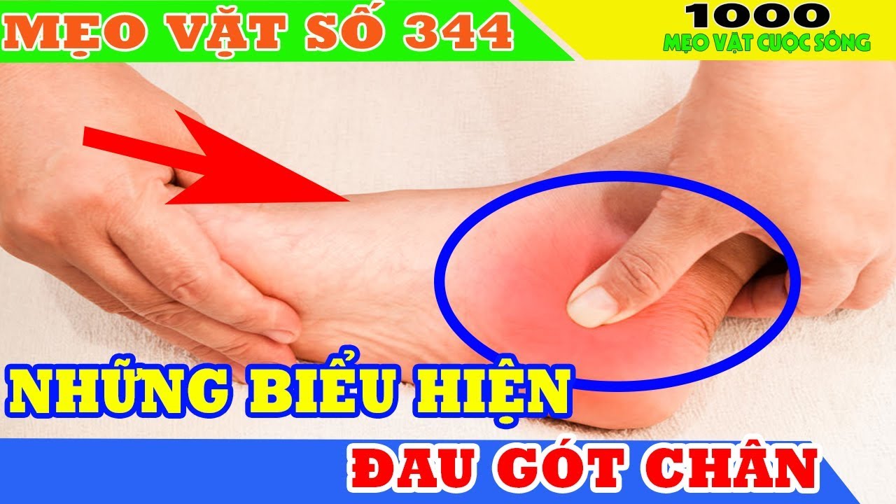 Đau gót chân và các dấu hiệu liên quan