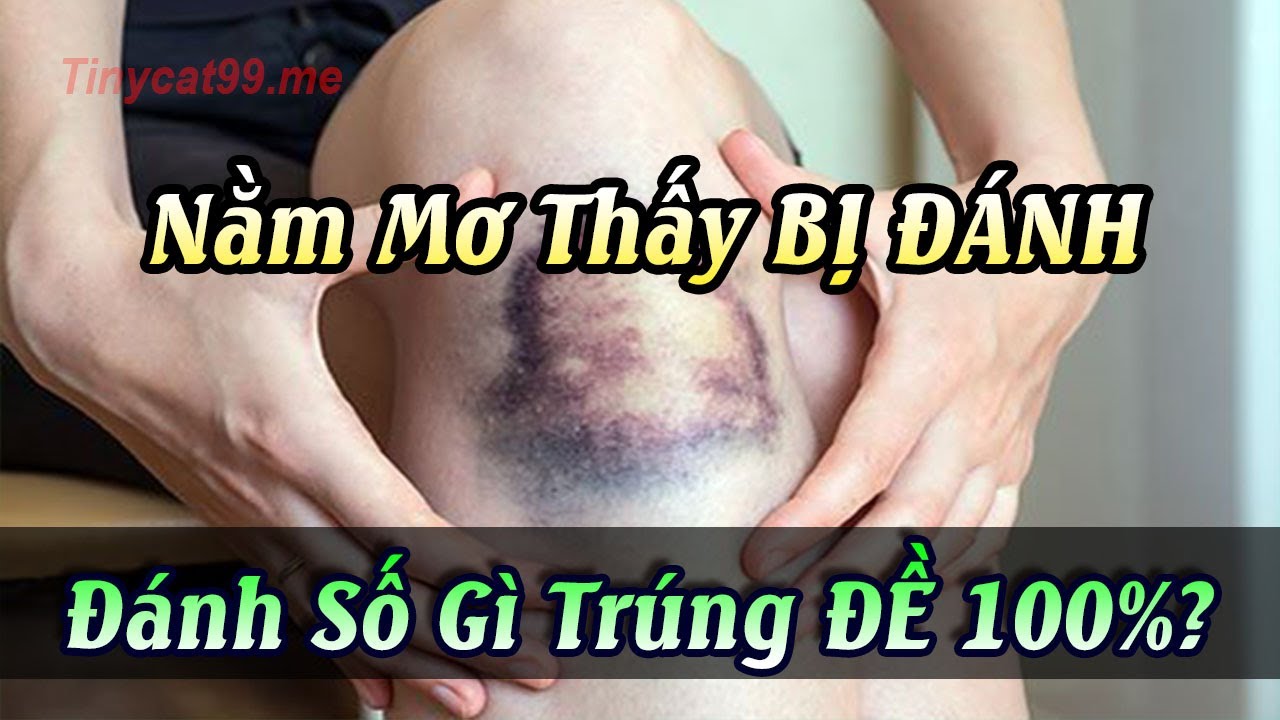 Người nằm mơ thấy bị đánh trong giấc mơ
