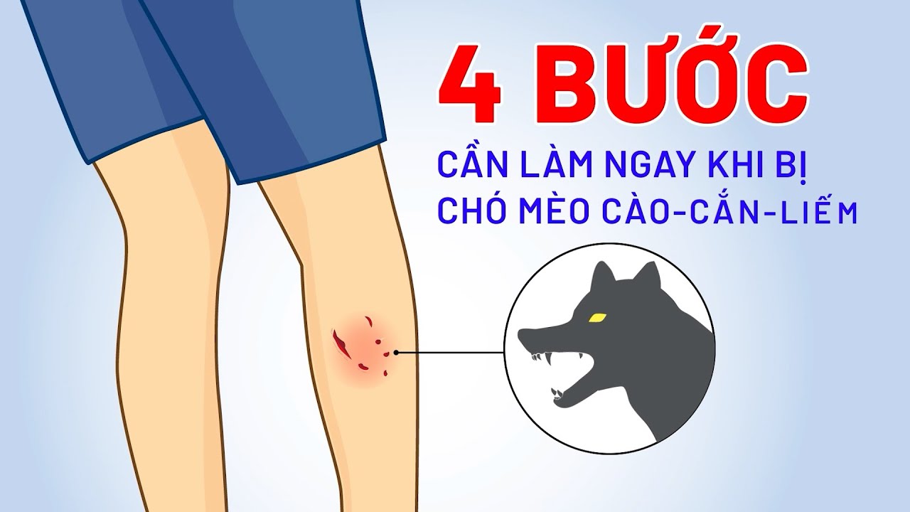Người nằm mơ bị chó cắn vào tay