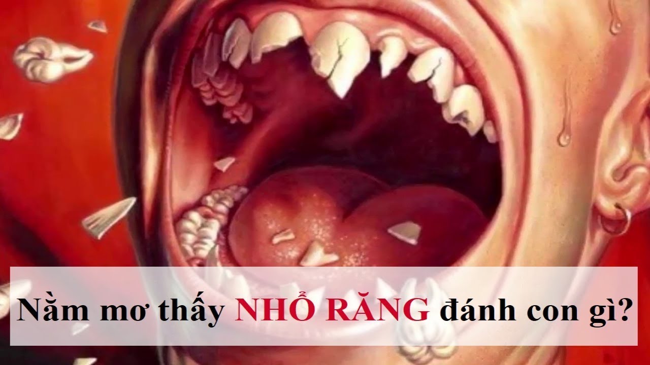 Người tự nhổ răng trong giấc mơ