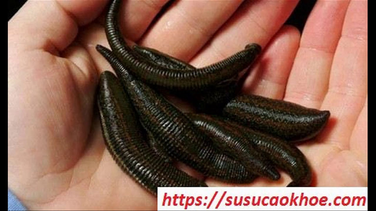 Đỉa xuất hiện trong giấc mơ ý nghĩa gì