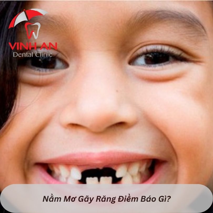 Nằm mơ rụng răng hàm dưới không chảy máu đánh đề