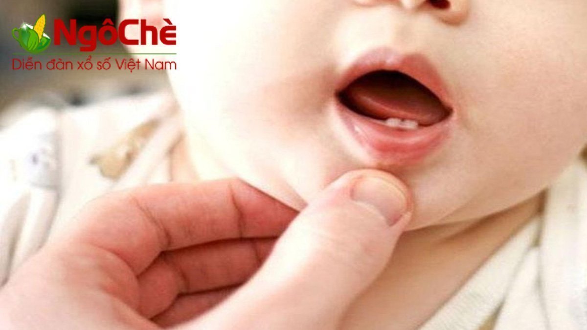 Mơ thấy nhổ răng đánh đề số mấy chuẩn nhất