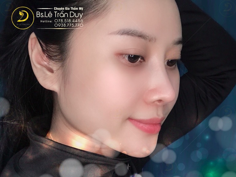 So sánh mũi tẹt với mũi cao
