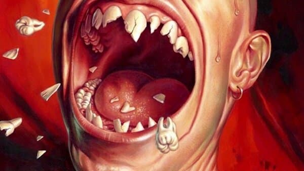 Nằm mơ thấy rụng răng hàm trên không chảy máu