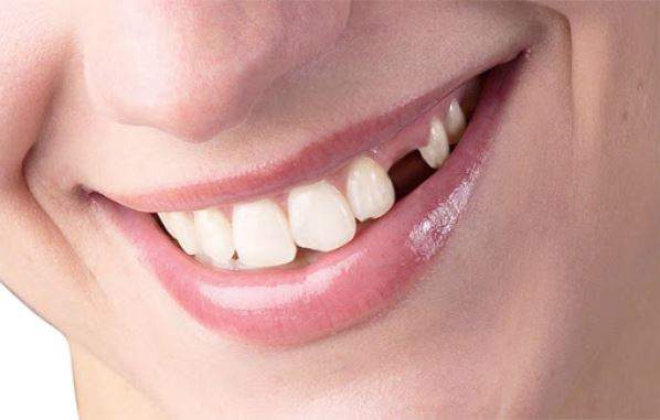 Người nằm mơ thấy rụng nhiều răng trên giường