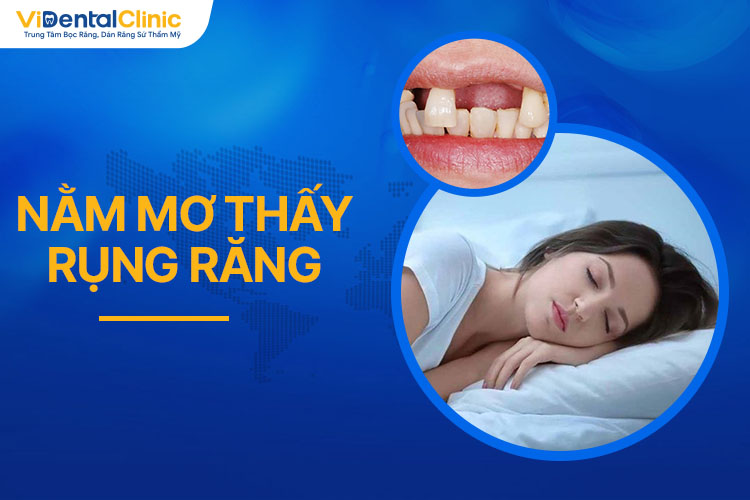 Hình ảnh minh họa liên quan đến giấc mơ rụng răng