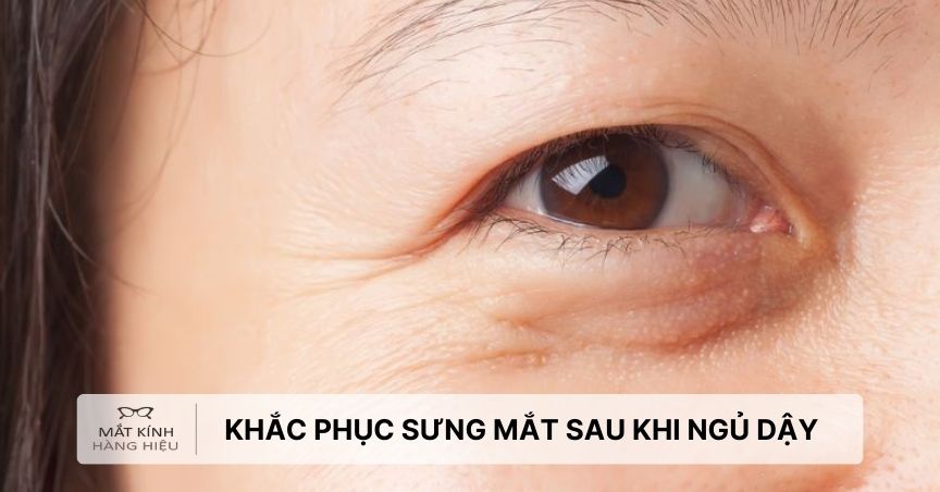 Mắt phải sưng sau khi ngủ dậy