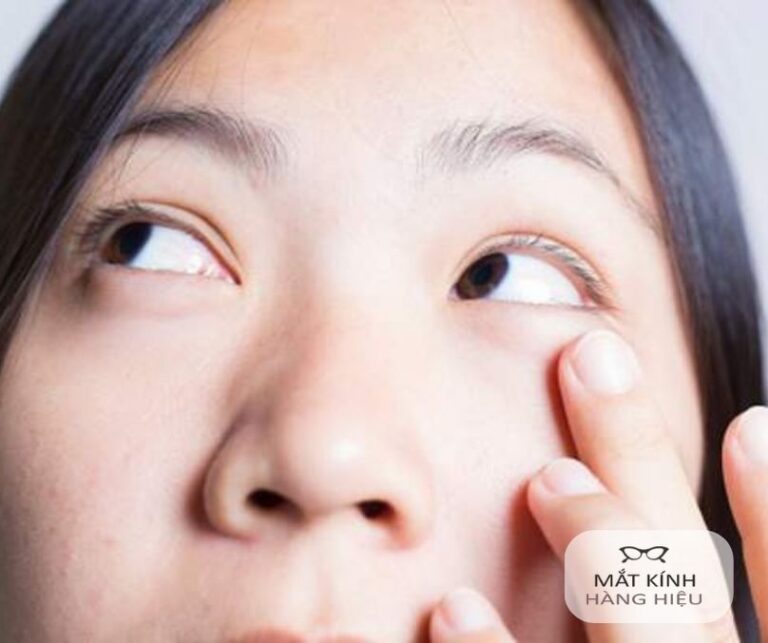 Người đang dụi mắt phải nhẹ nhàng