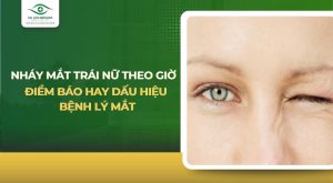 Hiện tượng mắt trái nữ giật nhẹ
