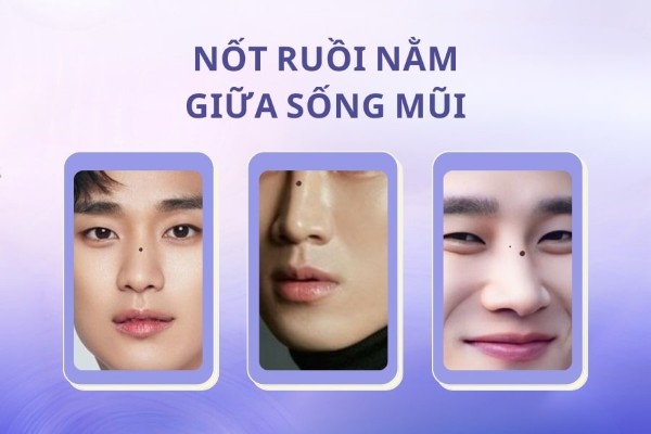 Các vị trí nốt ruồi không tốt cho nam