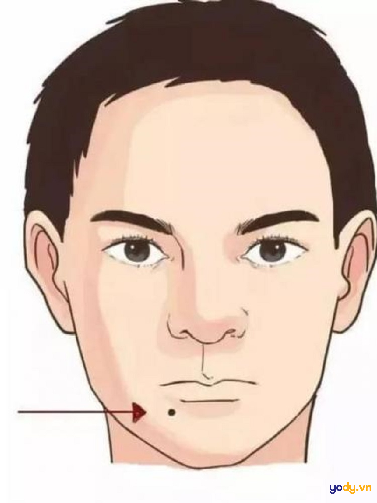 Hình ảnh nốt ruồi dưới cằm
