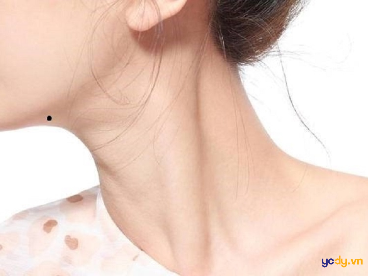 Nốt ruồi cằm phải ở nữ