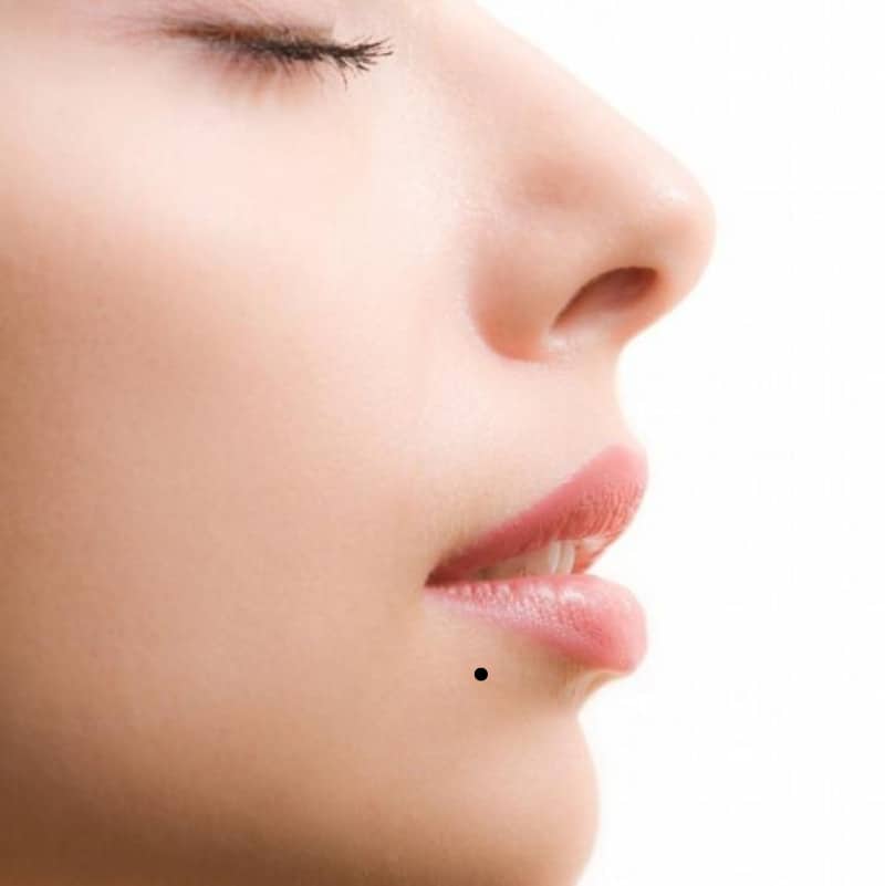 Nốt ruồi dưới miệng bên phải