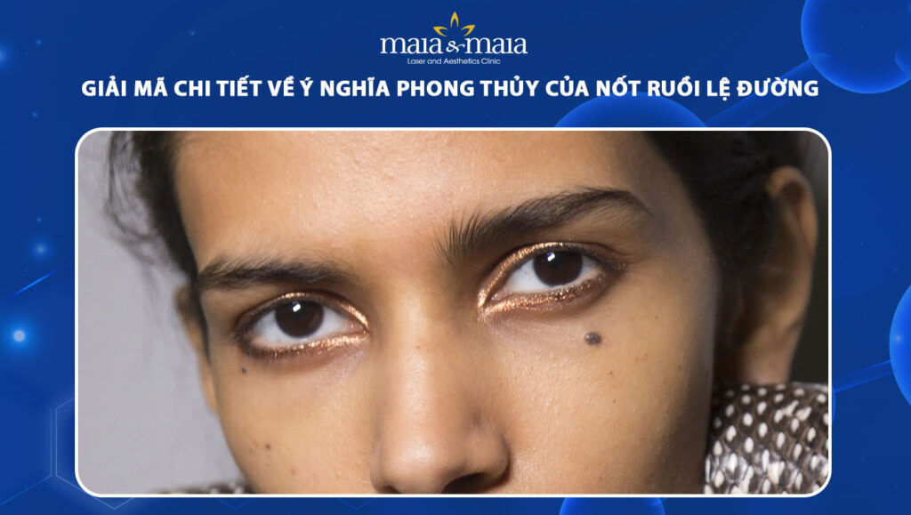 Vị trí nốt ruồi lệ trên khuôn mặt