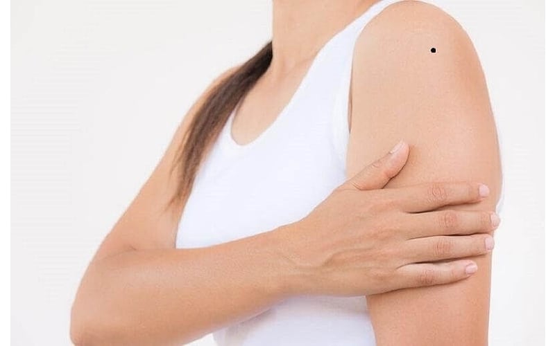 Nốt ruồi ở cánh tay trái nam nữ