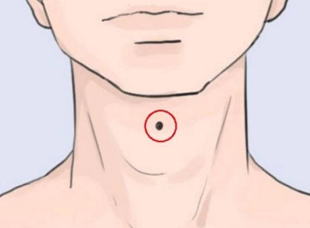 Nốt ruồi ở cổ nam giới