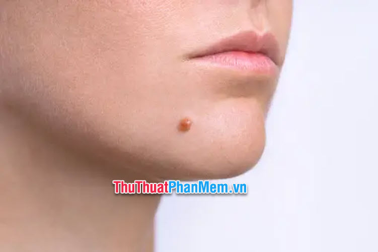 Nốt ruồi ở cằm phải nam giới