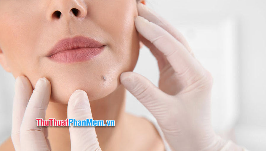Nốt ruồi dưới cằm trái nữ giới