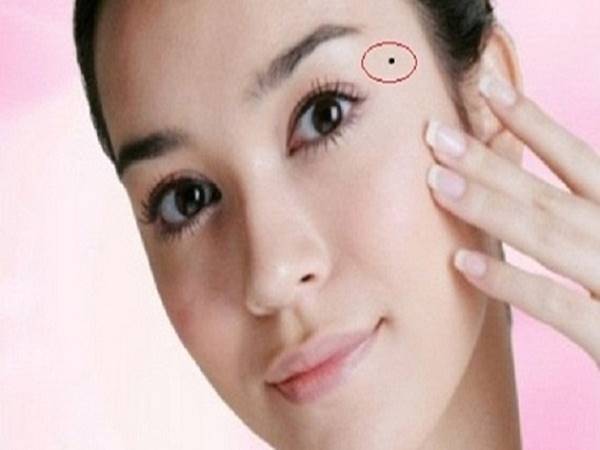 Nốt ruồi ở đuôi mắt trái và phải