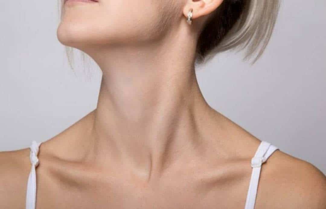 Minh họa nốt ruồi hõm cổ