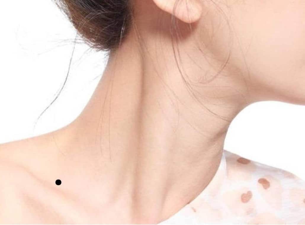 Nốt ruồi ở hõm cổ nam nữ