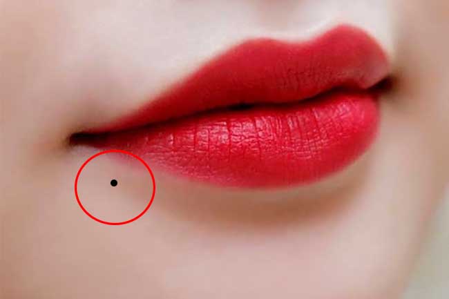 Nốt ruồi ở môi dưới bên trái