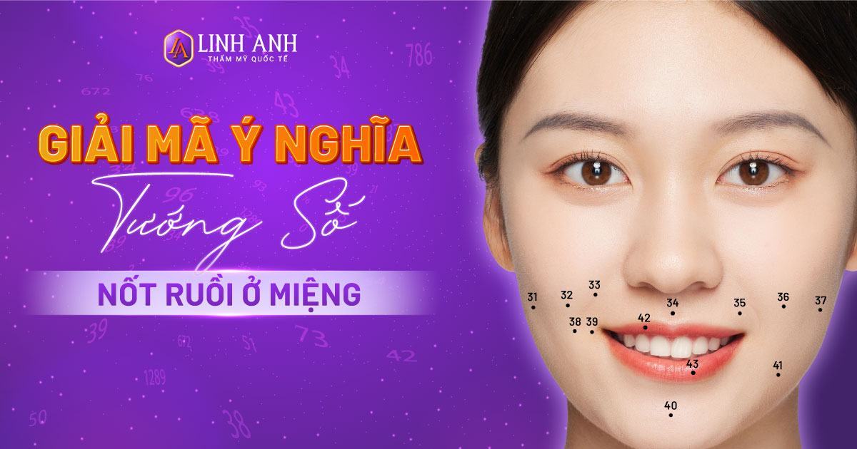 Các dạng nốt ruồi quanh miệng