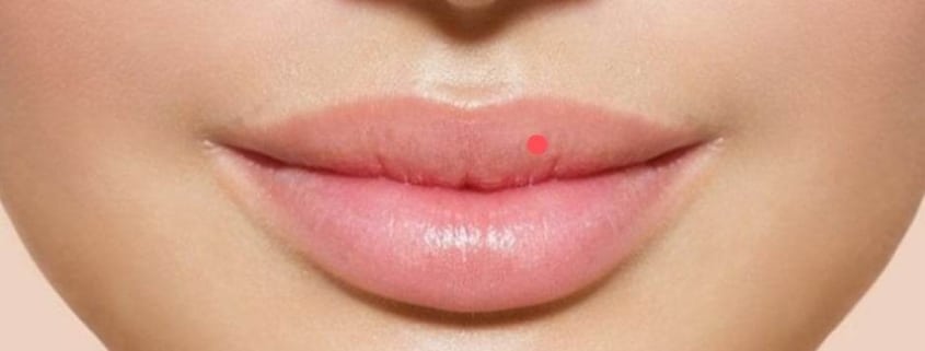 Nốt ruồi ở môi nữ giới nhìn nghiêng