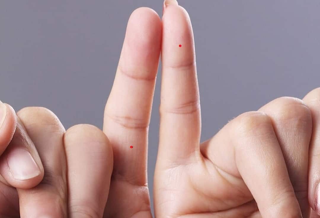 Nốt ruồi ở ngón tay út của nam và nữ