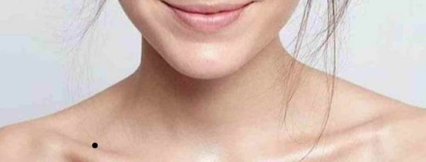 Vị trí nốt ruồi trên xương quai xanh