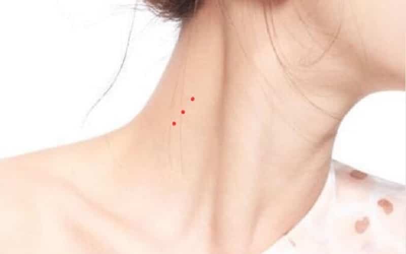 Nốt ruồi và ý nghĩa theo phong thủy