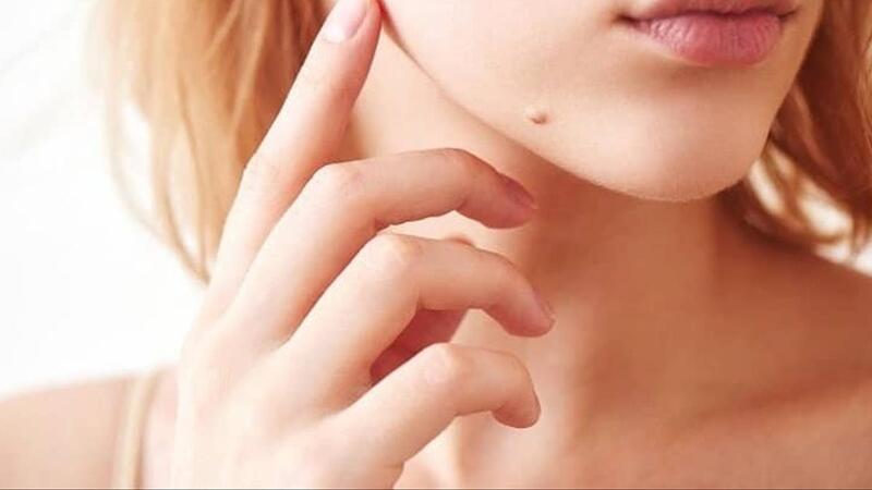 Minh họa vị trí nốt ruồi trên khuôn mặt