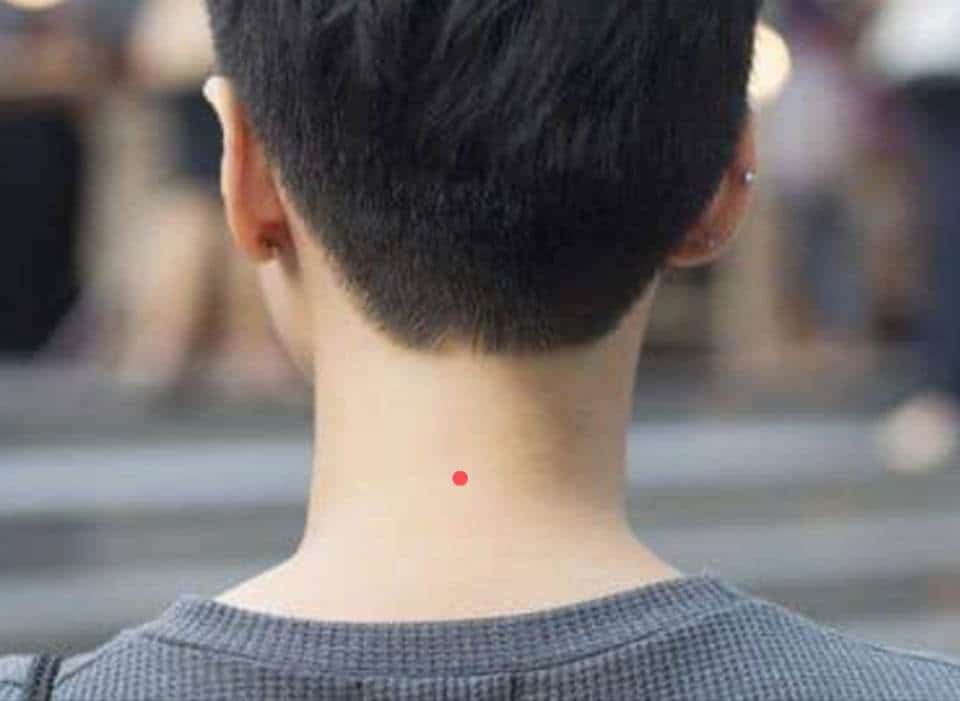 Nốt ruồi sau gáy đàn ông