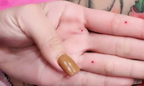 Giải nghĩa nốt ruồi son ở lòng bàn tay