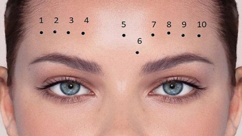 Vị trí nốt ruồi trên trán