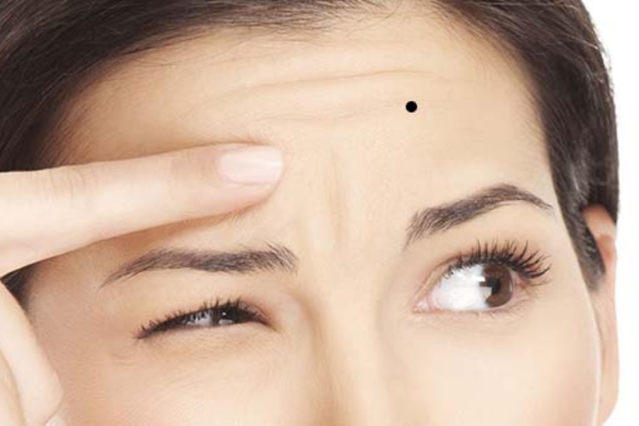 Vị trí nốt ruồi xấu ở phụ nữ