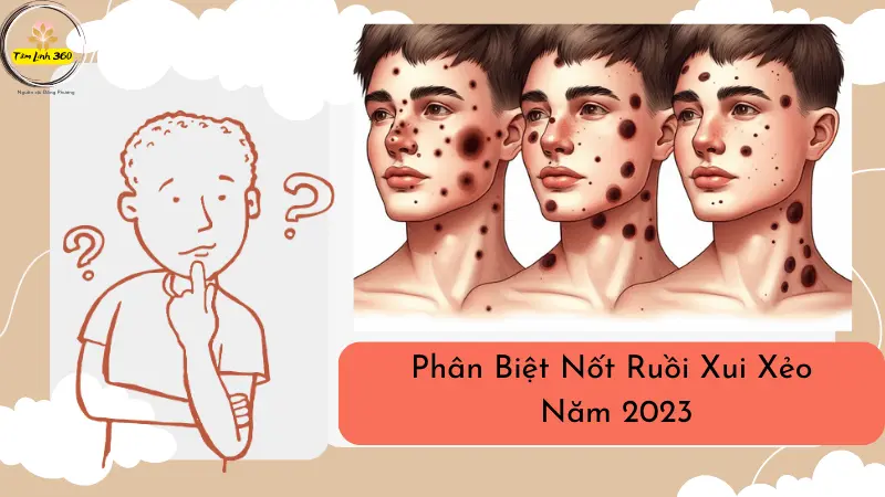 Hình ảnh phân biệt nốt ruồi xui xẻo