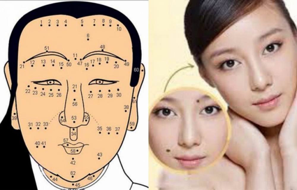 Vị trí nốt ruồi cần lưu ý trên gương mặt