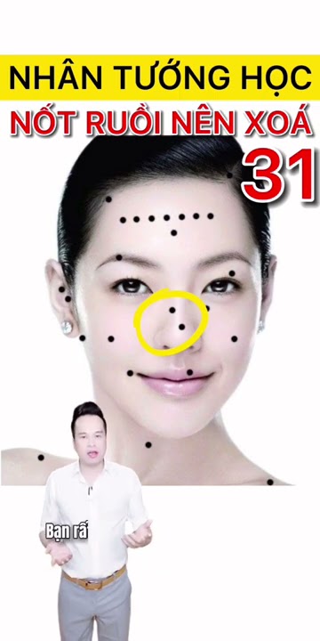 Nốt ruồi trên mặt và ý nghĩa tướng số