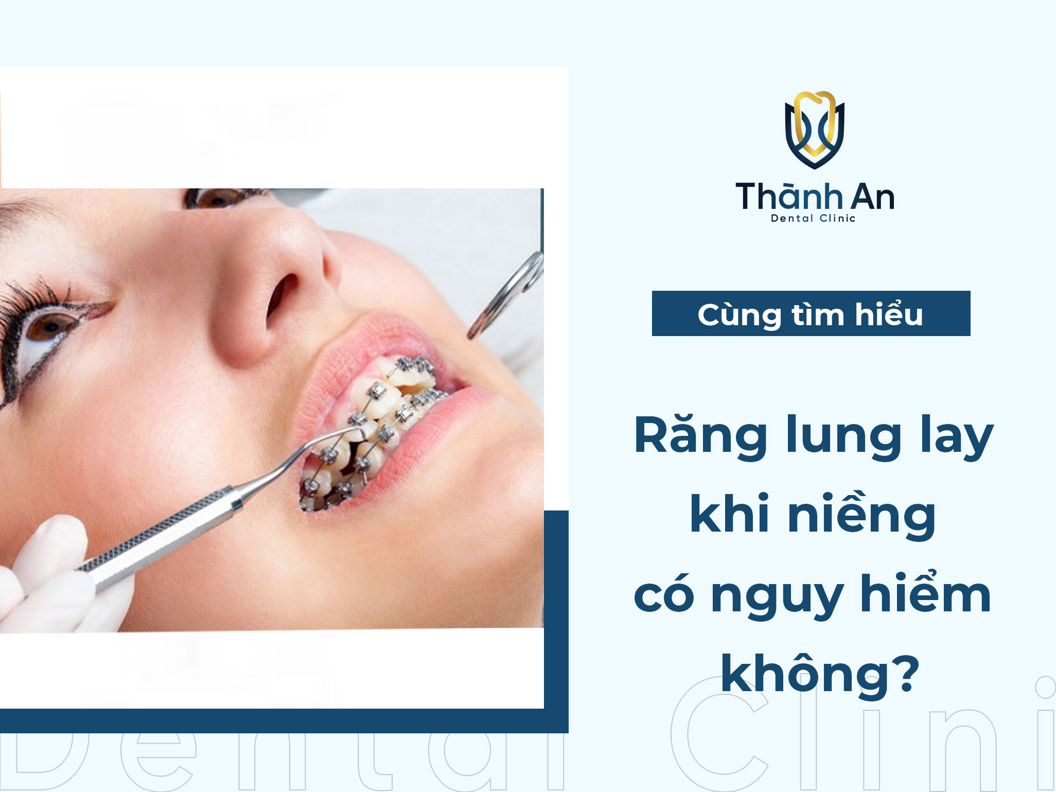 Răng lung lay trong giấc mơ và con số may mắn