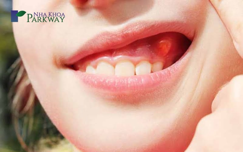 Răng lung lay trong giấc mơ ý nghĩa điềm báo