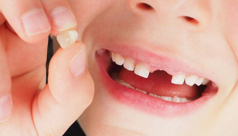 Người nằm mơ thấy rụng răng không chảy máu