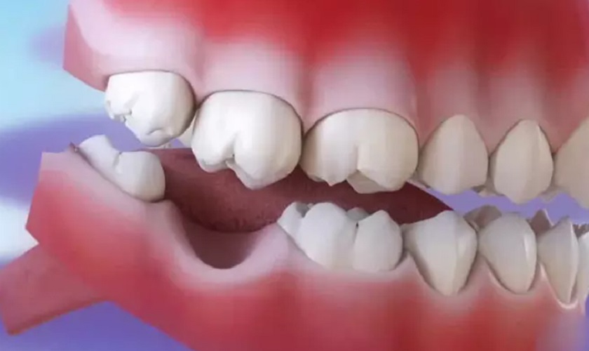 Người nằm mơ thấy rụng răng ban đêm