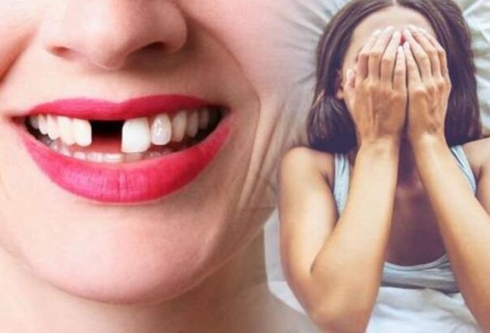 Mơ thấy rụng răng đánh đề số gì chuẩn nhất