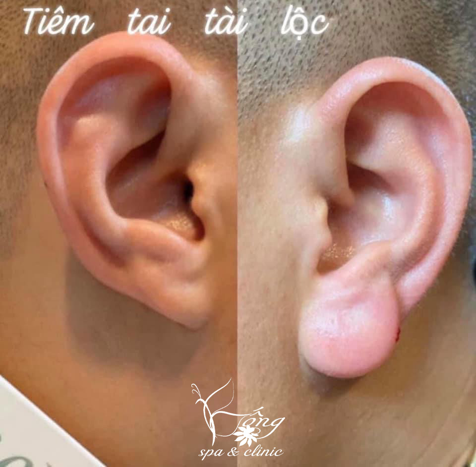 Tướng tai tài lộc ở nam giới