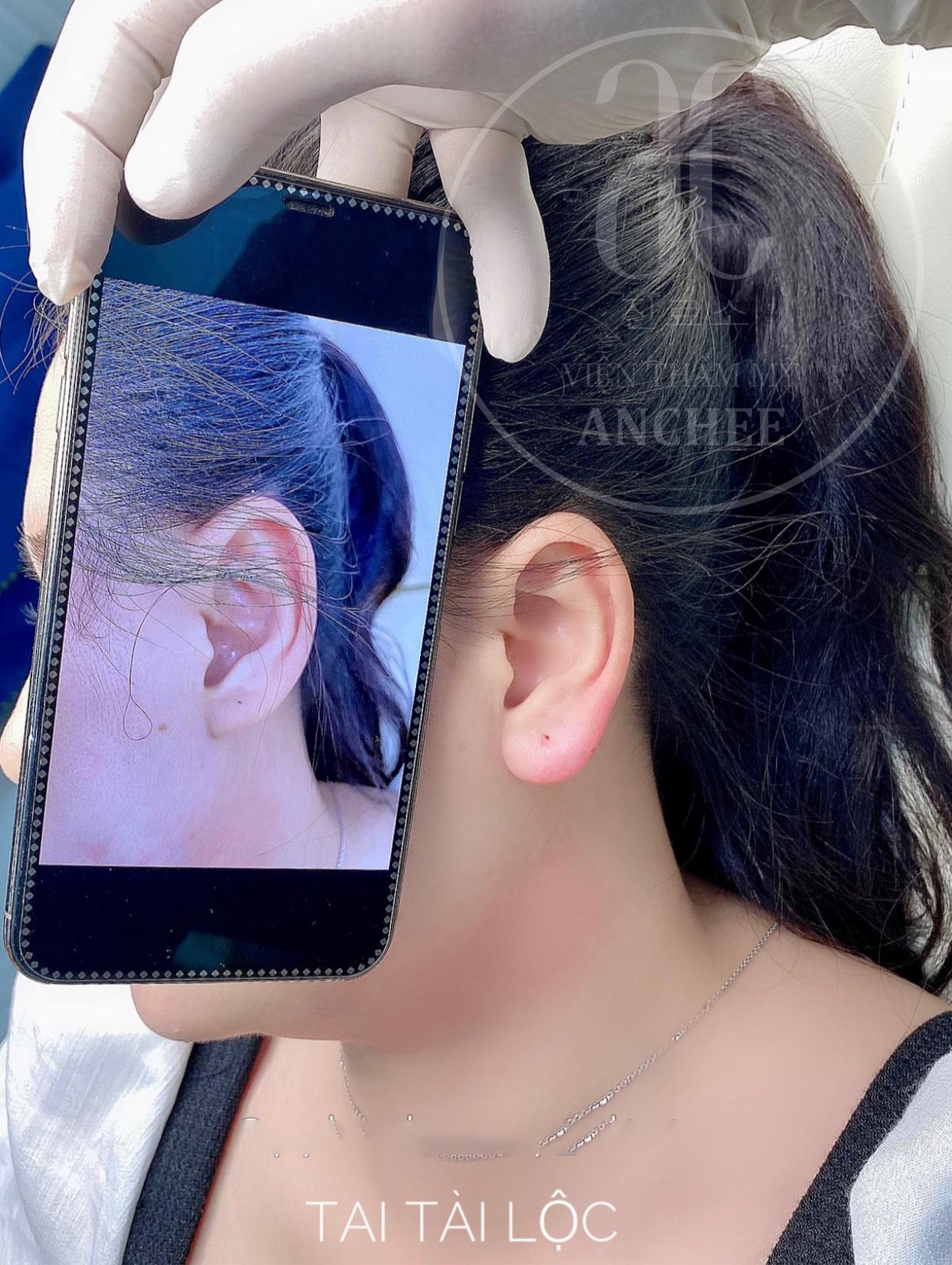 Tai đàn ông có dấu hiệu tài lộc
