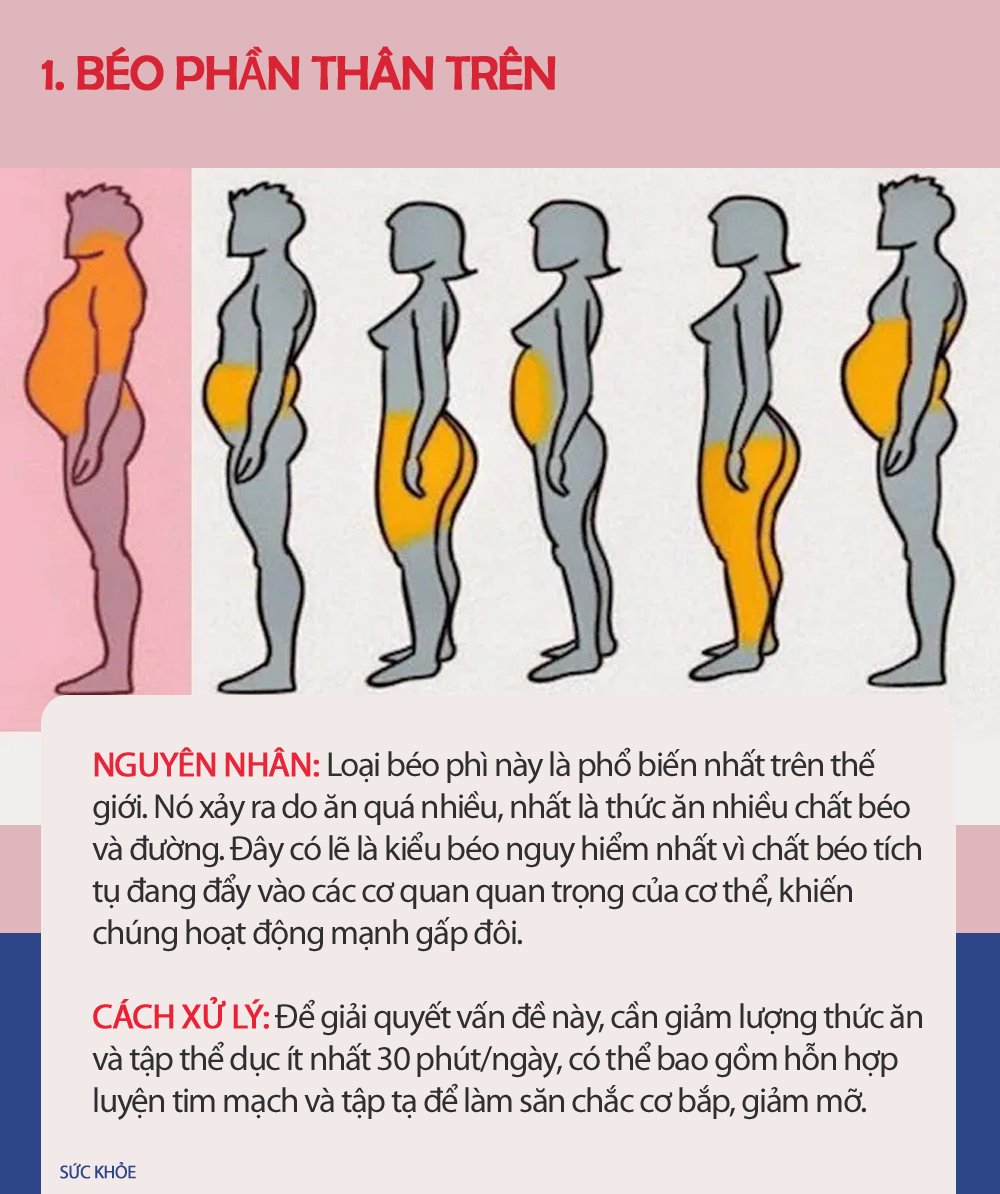 Xác định vị trí thừa mỡ trên cơ thể